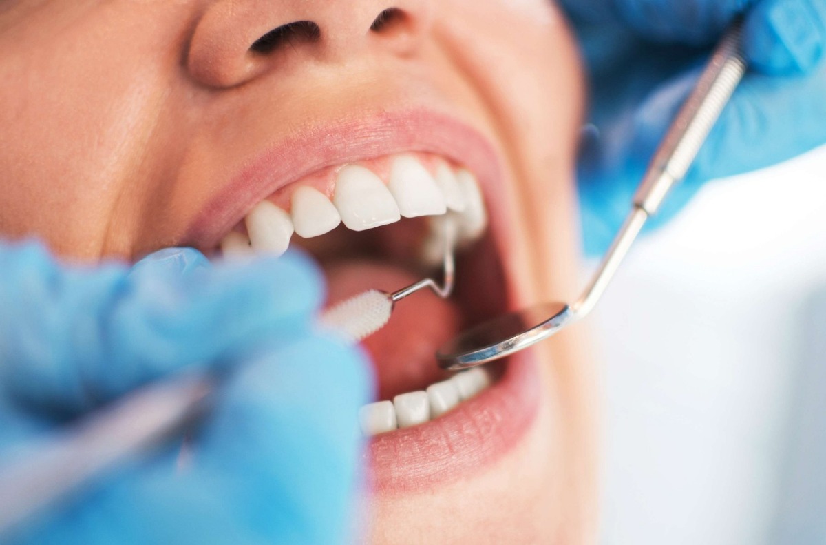 odontologia-general-limpieza-dental-blanqueamiento-y-mas-D_NQ_NP_954677-MLV29310575183_022019-F